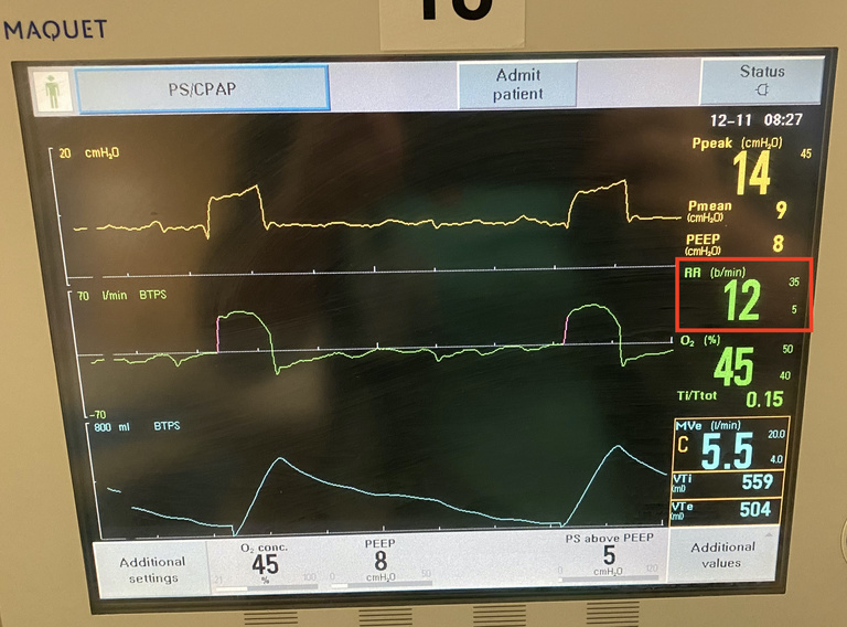 Respiratory rate, highlighted in red